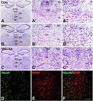 Involvement of the Ventrolateral Periaqueductal Gray Matter-Central Medial Thalamic Nucleus-Basolateral Amygdala Pathway in Neuropathic Pain Regulation of Rats